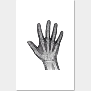 Radiologists Favorite X-ray Hand Posters and Art